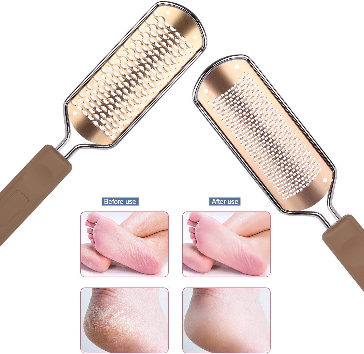 (2 Foot File) - 2Pcs Pedicure Rasp Foot File Callus Remover,Professional Stainless Steel Colossal and Fine Foot Scrubber Remove Dead Skin for Wet and Dry Feet