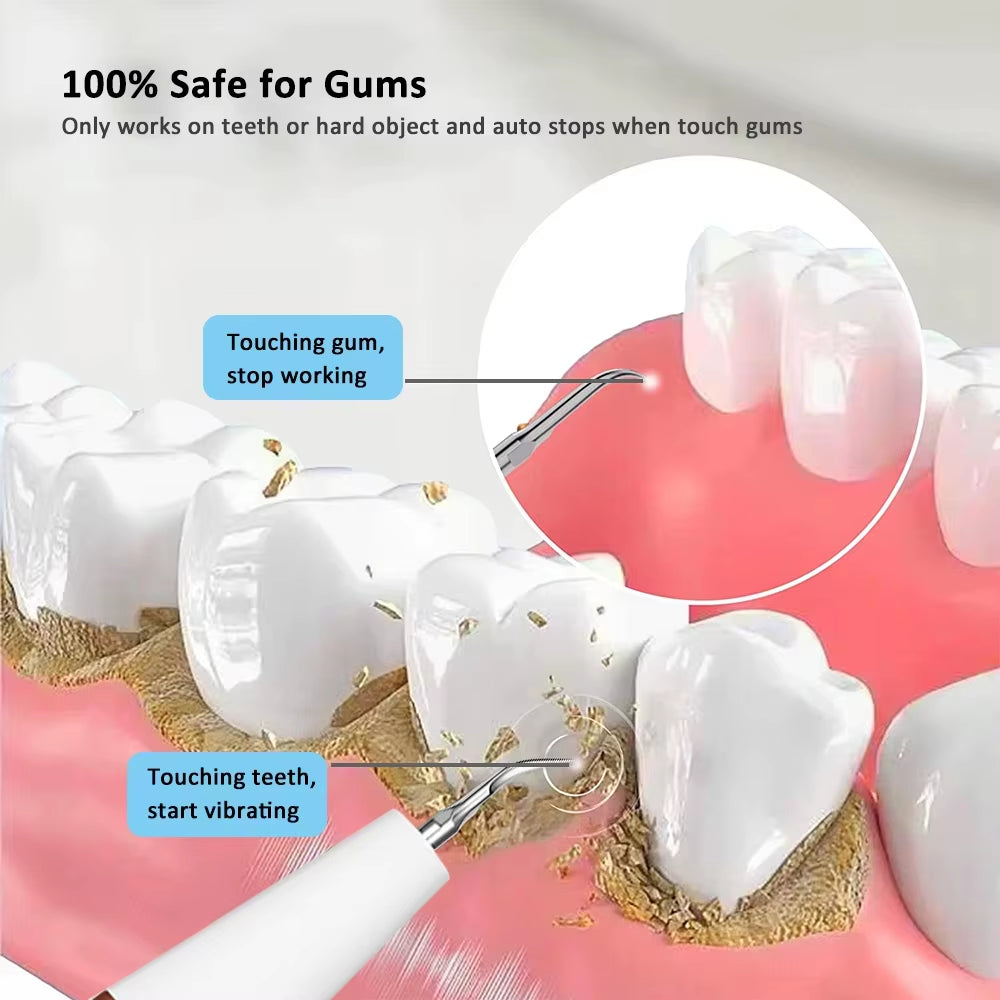 Ultrasonic Dental Calculus Remover and Plaque Scaler for Effective Tartar and Stain Elimination