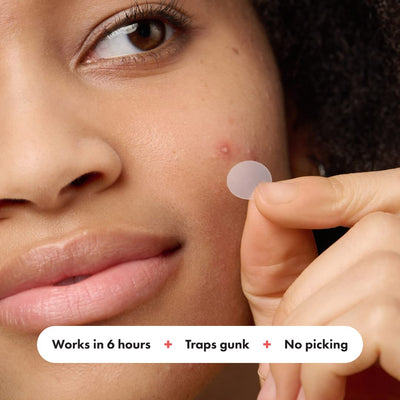 Mighty Patch™ Original - Hydrocolloid Acne Treatment Patches for Zits and Blemishes (72 Count)