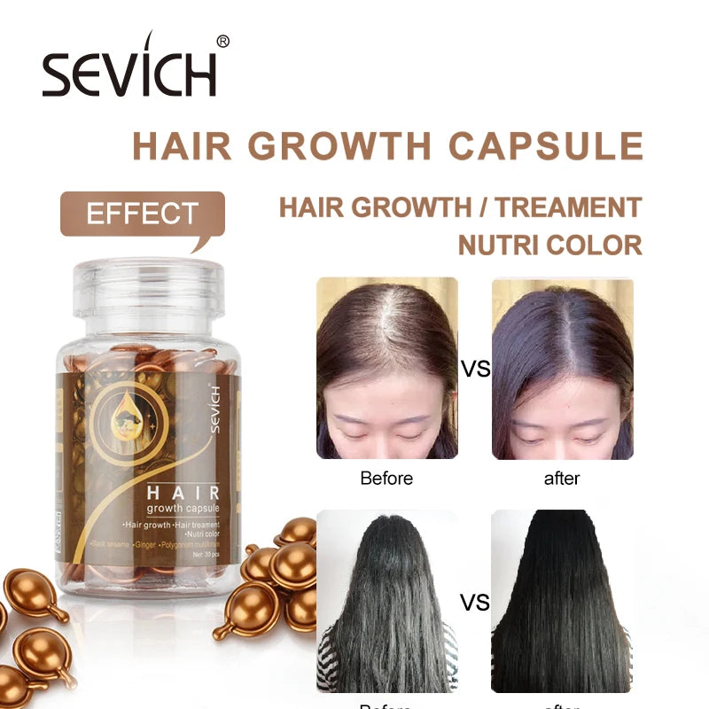 Castor Oil Keratin Complex Hair Vitamin Capsules for Nourishing Hair Regrowth and Repair, Anti-Hair Loss Treatment