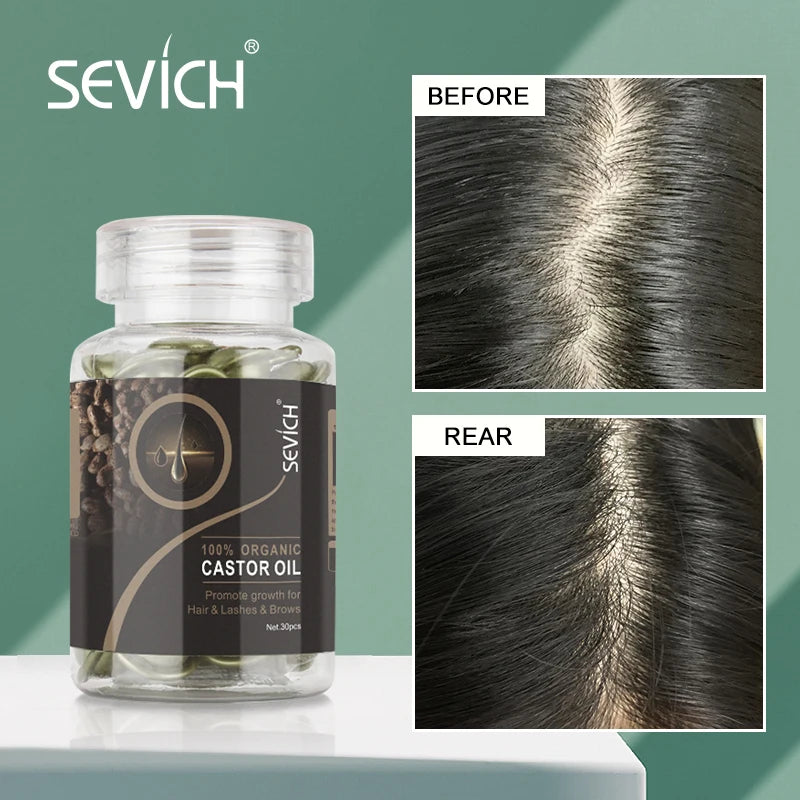 Castor Oil Keratin Complex Hair Vitamin Capsules for Nourishing Hair Regrowth and Repair, Anti-Hair Loss Treatment